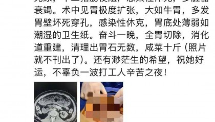 女子多器官衰竭、整个胃被摘除,医生清理出10斤……紧急提醒